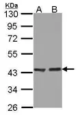 Anti-ACAA1 antibody used in Western Blot (WB). GTX114229