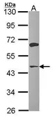 Anti-ACAA1 antibody used in Western Blot (WB). GTX114230