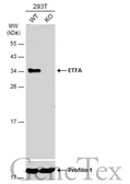 Anti-ETFA antibody used in Western Blot (WB). GTX114392