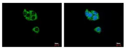 Anti-GCDH antibody used in Immunocytochemistry/ Immunofluorescence (ICC/IF). GTX114427