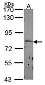 Anti-SEMA3F antibody [N1N2], N-term used in Western Blot (WB). GTX114743