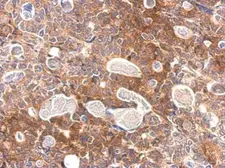 Anti-Slap antibody used in IHC (Paraffin sections) (IHC-P). GTX114763