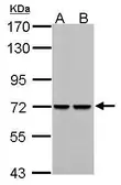 Anti-PCK2 antibody used in Western Blot (WB). GTX114919