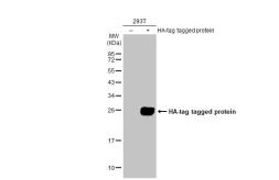 Anti-HA tag antibody used in Western Blot (WB). GTX115044