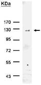 Anti-6X His tag antibody used in Immunoprecipitation (IP). GTX115045
