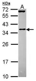 Anti-EIF3J antibody [N2C3] used in Western Blot (WB). GTX115121