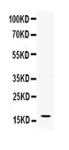 Anti-Interferon gamma antibody used in Western Blot (WB). GTX11516