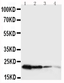 Anti-Growth Hormone antibody used in Western Blot (WB). GTX11522