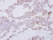 Anti-GRAP2 antibody used in IHC (Paraffin sections) (IHC-P). GTX115233