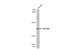 Anti-SETDB1 antibody [N1], N-term used in Western Blot (WB). GTX115305