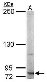 Anti-RNF10 antibody used in Western Blot (WB). GTX115316