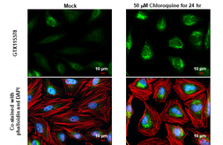 Anti-NDP52 antibody used in Immunocytochemistry/ Immunofluorescence (ICC/IF). GTX115378