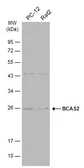 Anti-BCAS2 antibody used in Western Blot (WB). GTX115390