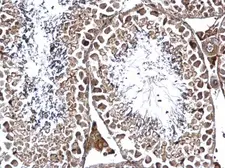 Anti-GPN1 antibody used in IHC (Paraffin sections) (IHC-P). GTX115620