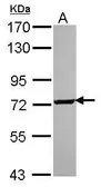 Anti-SCMH1 antibody used in Western Blot (WB). GTX115653