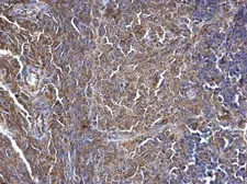Anti-SWAP70 antibody used in IHC (Paraffin sections) (IHC-P). GTX115667