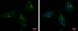 Anti-ACOT9 antibody [N1C1] used in Immunocytochemistry/ Immunofluorescence (ICC/IF). GTX115724