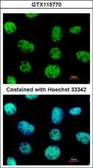 Anti-VAX2 antibody used in Immunocytochemistry/ Immunofluorescence (ICC/IF). GTX115770