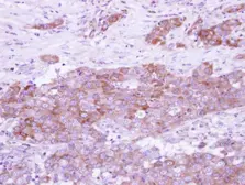 Anti-ARFGAP3 antibody [N3C3] used in IHC (Paraffin sections) (IHC-P). GTX115818