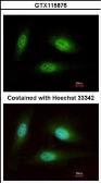 Anti-WDR91 antibody [N1N2], N-term used in Immunocytochemistry/ Immunofluorescence (ICC/IF). GTX115876