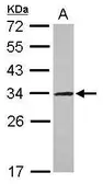 Anti-UTP11L antibody [N1C3] used in Western Blot (WB). GTX115929