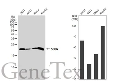 Anti-SOD2 antibody used in Western Blot (WB). GTX116093