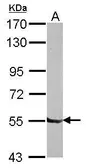 Anti-DBR1 antibody [N1C1] used in Western Blot (WB). GTX116142
