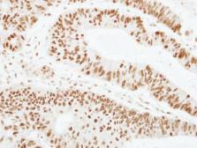 Anti-ZNF207 antibody [N3C3] used in IHC (Paraffin sections) (IHC-P). GTX116214