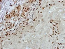 Anti-BRF2 antibody [N1C1] used in IHC (Paraffin sections) (IHC-P). GTX116223