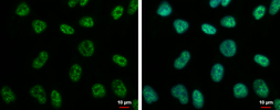 Anti-CHFR antibody used in Immunocytochemistry/ Immunofluorescence (ICC/IF). GTX116261