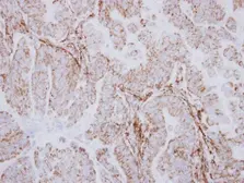 Anti-AspRS antibody [N1N3] used in IHC (Paraffin sections) (IHC-P). GTX116291