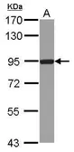 Anti-DTX3L antibody [N1N2], N-term used in Western Blot (WB). GTX116369