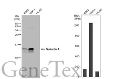 Anti-Galectin 1 antibody used in Western Blot (WB). GTX116411