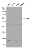 Anti-GIT2 antibody [N1N3] used in Western Blot (WB). GTX116427