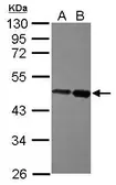 Anti-ZBTB26 antibody [N3C3] used in Western Blot (WB). GTX116694