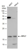 Anti-MYL7 antibody used in Western Blot (WB). GTX116713