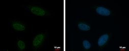 Anti-KCTD15 antibody used in Immunocytochemistry/ Immunofluorescence (ICC/IF). GTX116797