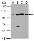 Anti-FAAP100 antibody [C2C3], C-term used in Western Blot (WB). GTX116871