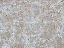 Anti-ITM2C antibody used in IHC (Paraffin sections) (IHC-P). GTX116904