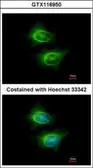 Anti-ASCC2 antibody [N3C2], Internal used in Immunocytochemistry/ Immunofluorescence (ICC/IF). GTX116950
