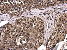 Anti-RERG antibody used in IHC (Paraffin sections) (IHC-P). GTX117011