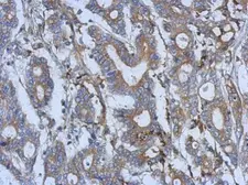 Anti-Semaphorin 5A antibody [N1N2], N-term used in IHC (Paraffin sections) (IHC-P). GTX117160