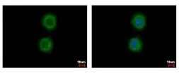 Anti-Cytokeratin 72 antibody used in Immunocytochemistry/ Immunofluorescence (ICC/IF). GTX117239