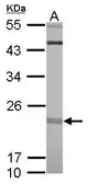Anti-RIT1 antibody used in Western Blot (WB). GTX117329