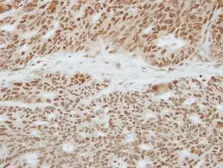 Anti-TOE1 antibody used in IHC (Paraffin sections) (IHC-P). GTX117545