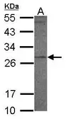Anti-PR3 antibody [N2C3] used in Western Blot (WB). GTX117576