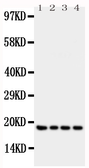 Anti-Interferon gamma antibody used in Western Blot (WB). GTX11759