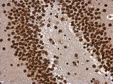 Anti-TBR1 antibody [N2C1], Internal used in IHC (Paraffin sections) (IHC-P). GTX117615