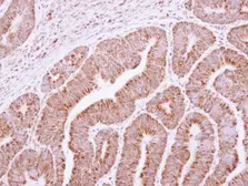 Anti-RRP4 antibody [N1C3] used in IHC (Paraffin sections) (IHC-P). GTX117616
