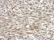 Anti-MMS2 antibody used in IHC (Paraffin sections) (IHC-P). GTX117707